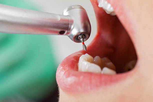 Best Tooth Infection Emergency Dentist  in Freeport, PA